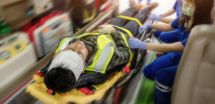 traumatic brain injury treatment in Irvine for auto accident injury patient